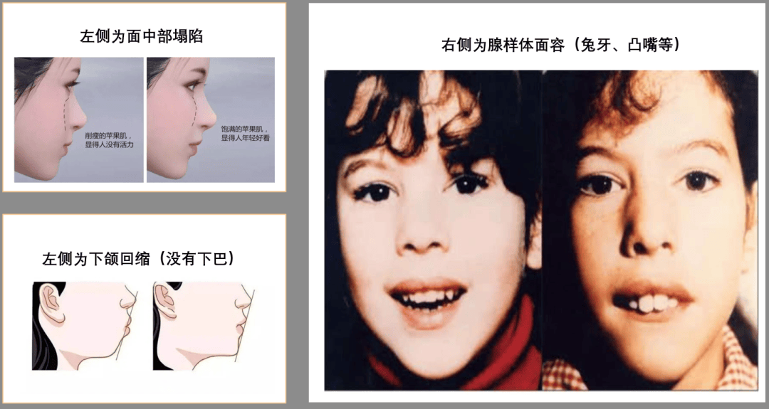 ?反复感染?可能有简单的解决方法!凯发·k8国际平衡力差?感统失调(图11) ?反复感染?可能有简单的解决方法!凯发·k8国际平衡力差?感统失调(图11)